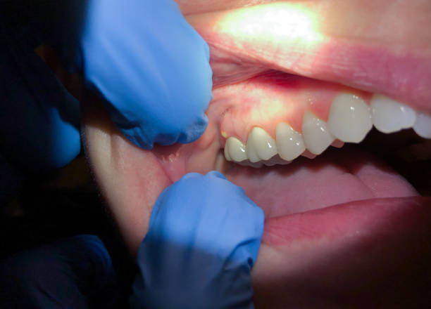 Best Dentist Open on Weekends  in Cross Mountain, TX