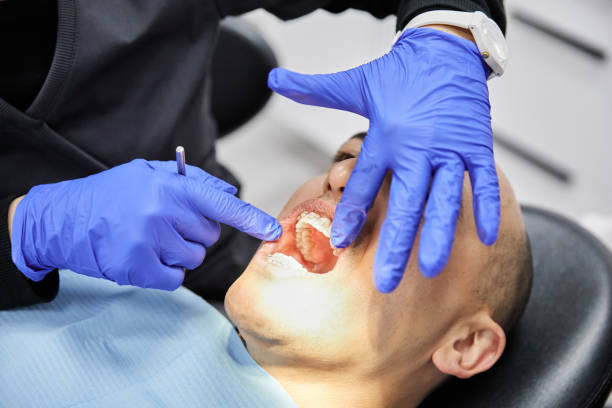Best Chipped Tooth Repair Near Me  in Cross Mountain, TX