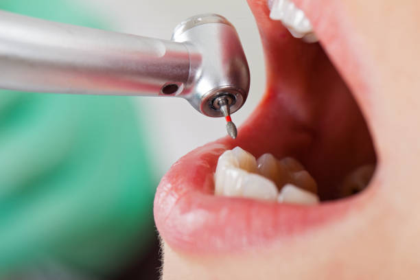 Best Knocked-Out Tooth Emergency  in Cross Mountain, TX